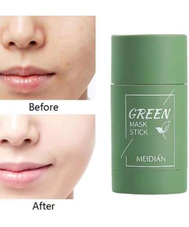 Green Mask Stick | Green Stick Blackhead | Masque l'argile purifiant en forme de stylo | Hydratant | Clarification de l'acn et dissolvant de points noirs pour peau pure en profondeur | Cleansstick - Buy Online on GoSupps.com