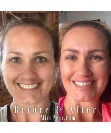 Collagen Peptides Face Serum 30ml | Anti-Aging Facial Serum | Tri-Peptide Firming Formula for Wrinkles & Fine Lines | Boost Elasticity & Radiance - Buy Online on GoSupps.com