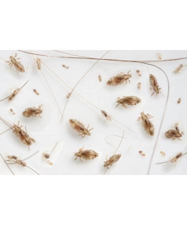 Nit Free Lice Mousse & Glue Dissolver (16 oz) - Fast & Effective Treatment - Buy Online on GoSupps.com