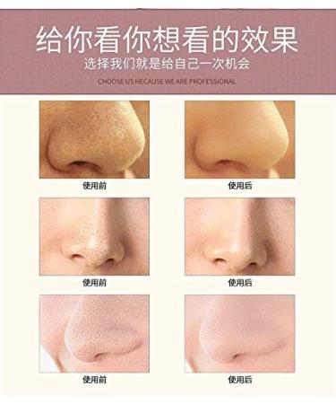 The Eighth Generation of Electric Blackhead Instrument Beauty Instrument Blackhead Cleaner Pore Cleaning go  - Buy Online on GoSupps.com