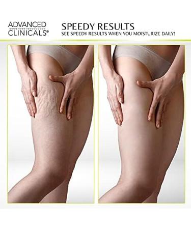 Advanced Clinicals Green Coffee Bean Oil Firming Cream + Vitamin C Body Oil Set - Buy Online on GoSupps.com