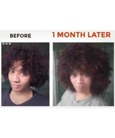 Gro-aut Herbal Hair Growth Oil - Fill Bald Patches, Reverse Hair Loss, Grow Long Hair - 8oz (1 Pack) - Buy Online on GoSupps.com