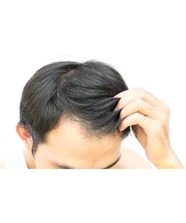 The Fitzrovia Centre Shampoo For Hair Growth - Thickening for Hair Loss & Fast Hair Regrowth Shampoo - Hair Scalp Moisturizer & Booster - Healthy Shampoo for Thinning Hair - Buy Online on GoSupps.com