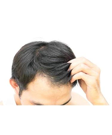 Hair Growth Conditioner - Stimulating Formula for Hair Loss Treatment | Redensyl vs Minoxidil | 250ml - Buy Online on GoSupps.com