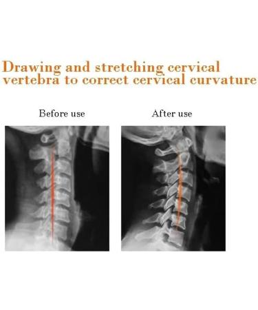 KCHYCV Natural Tourmaline Massage Pillow - Infrared Physiotherapy for Back & Cervical Traction | 1PCS-01 - Buy Online on GoSupps.com