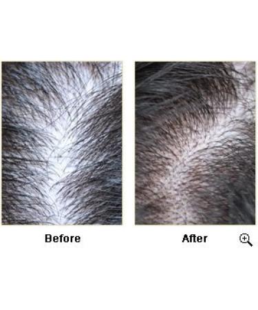 Organic Hair and Scalp Tonic | Nourishing Formula with Vitamins | 24-Hour Moisturizing Action | 4oz - Buy Online on GoSupps.com