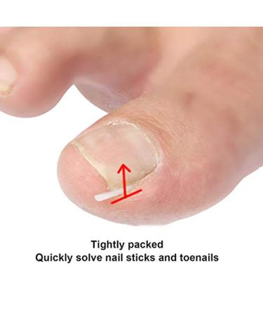 60+2 Pack Ingrown Toenail Treatment Set - Includes Corrector Strips, Lifter, and Nail Clipper - Professional Ingrown Toenail Correction Tool - Buy Online on GoSupps.com