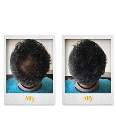 Alfy Hair Building Fibers for Thinning Hair - Dark Brown 12g | Boost Volume & Density - Buy Online on GoSupps.com