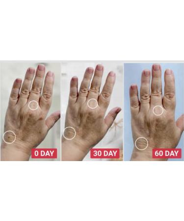 LifeCell Overnight Hand Treatment - 1 oz - Pack of 1 - Buy Online on GoSupps.com