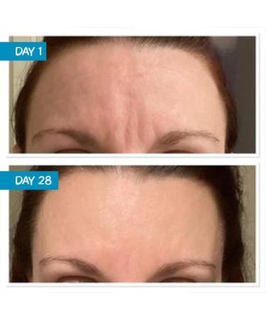 MooGoo Amplified Anti-Ageing Serum with Argireline Amplified Peptide - 50x More Potent Than Regular Argireline Peptide - Buy Online on GoSupps.com