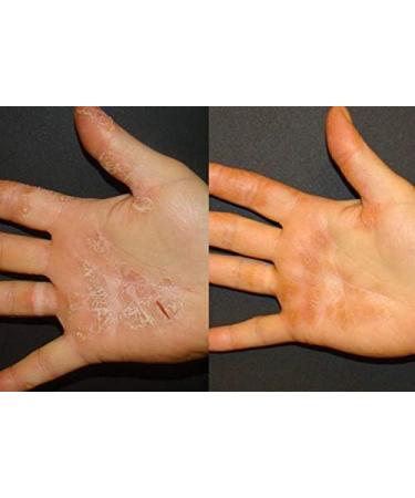 FixMySkin Healing Body Balm 0.5 oz - Fragrance-Free Moisturizer for Dry Skin and Eczema Relief - Buy Online on GoSupps.com