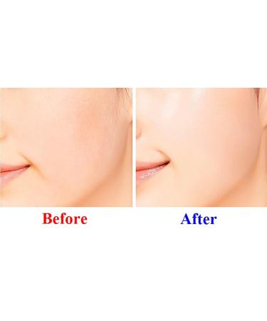 K-Beauty Oil Free Water Gel Cream with 9 Exosome & Nano-Hyaluronic | Hydrating Moisturizer 100ml - Buy Online on GoSupps.com