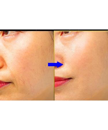 Buy K-Beauty Anti-Aging Ampoule Serum - 85% Human Stem Cell & 10% PDRN - 12 Vials (120ml) - Visible Repair & Rejuvenation - Buy Online on GoSupps.com
