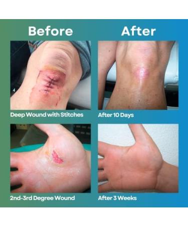 MEDIQUICK Skin & Wound Mist Treatment | Healing First Aid Spray for Cuts, Burns, and Scrapes | Soothes Itching, Inflammation | 4oz Bottle - Buy Online on GoSupps.com