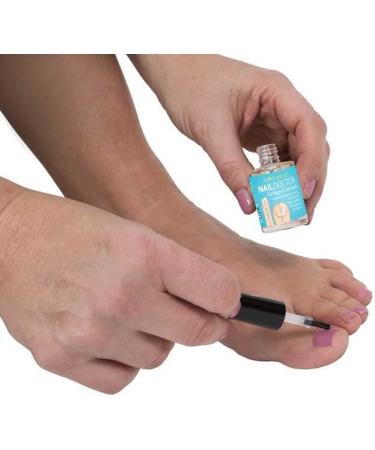VYTALIVING BioClear Nail Doctor - Ingrown Toenail Treatment - Fungal Nail Treatment for Toenail Aids in Toe Nail Care | 15 ml - Buy Online on GoSupps.com