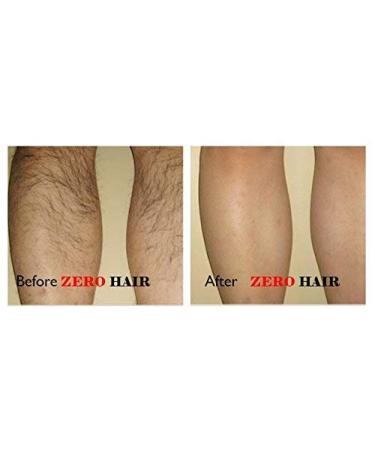 ZeroHair Painless Depilatory Cream for Men & Women | Fast-Acting Hair Removal for Body & Private Parts | 200ml Kachita Spell - Buy Online on GoSupps.com