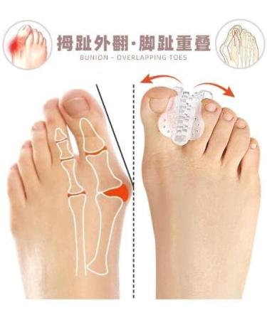 Clear Gel Toe Separators & Straightener for Hammer Toe - Hallux Valgus Corrector & Pads - Overlapping Toe Spacers - Clear Pumice Sponge - One Size - Buy Online on GoSupps.com