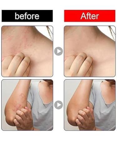 OYUCDAGQ Herbal Ointment Herbal Cream Herbal Body Ointment Natural Chinese Ointment External Chinese Creams 30g - Buy Online on GoSupps.com