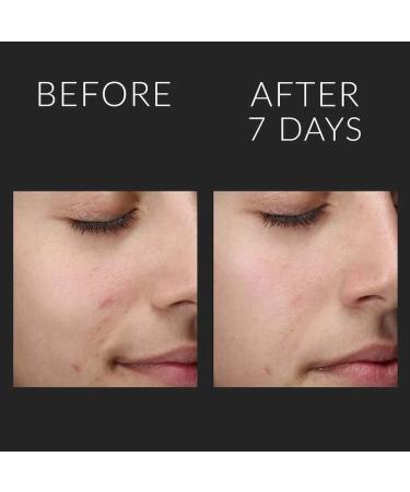 Kate Somerville Liquid ExfoliKate Triple Acid Resurfacing Treatment - 4 Fl Oz - Overnight Facial Exfoliator for Smooth Skin and Minimized Pores - Buy Online on GoSupps.com