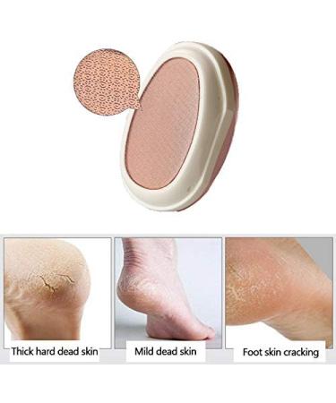 IKAAR Foot File Foot Pedicure Tool Foot File Dead Skin Remover Foot Care Pedicure Tool for Cracked Feet Make Foot Beauty and Extra Smooth (Rose Gold) - Buy Online on GoSupps.com