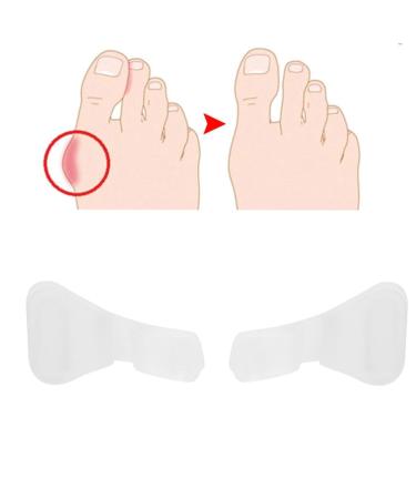 Allesoky Toe Separator Corrector Orthotics - Foot Pain Relief and Alignment Tool - Buy Online on GoSupps.com