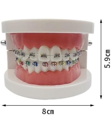 Tooth Demonstration Model - Dental Typodont with Orthodontic Bracket for Dentist Research | International Shipping - Buy Online on GoSupps.com