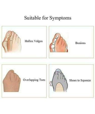 ERINSHOP Toe Separators - Big Toe Alignment Spacers for Bunions - Bunion Relief for Men and Women - 1 Pair White - Buy Online on GoSupps.com