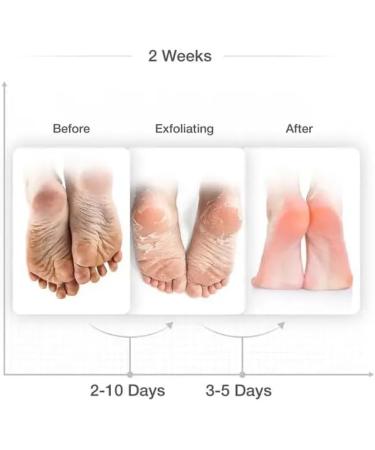 Palmarisa - Foot Peel Mask with Aloe Vera & Tea Tree - 2 Pack Peel off Peeling Socks | Removes Heel Callus | Exfoliates Dead Skin | Treats hard skin | Repairs Cracked Heels | Moisturises Feet - Buy Online on GoSupps.com