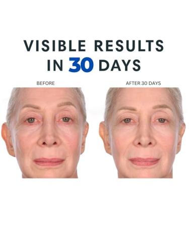 Consult Beaute XTERNA-Q Anti-Aging Universal Day and Night CoQ10 Cream Face Moisturizer and Serum for Dry Skin DUO - Peptide Q10, Niacinamide - Restore Skin Barrier - Visibly Reduce Lines & Wrinkles - Buy Online on GoSupps.com