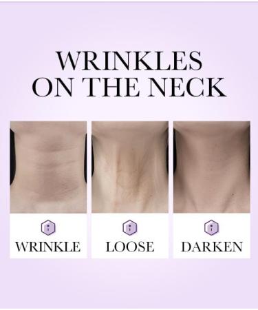 SADOER Neck Collagen Cream - Firming & Lifting Anti-Aging Moisturizer for Face & Neck Anti-Wrinkle Collagen Cream (International Shipping - Buy Online on GoSupps.com