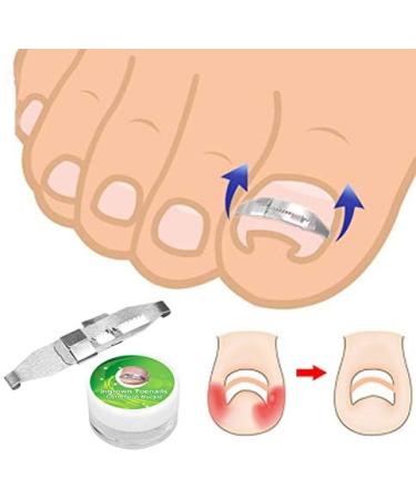 ANGGREK Ingrown Toenail Corrector | Stainless Steel Tool for Pain Relief & Correction | Effective Ingrown Toenail Treatment - Buy Online on GoSupps.com