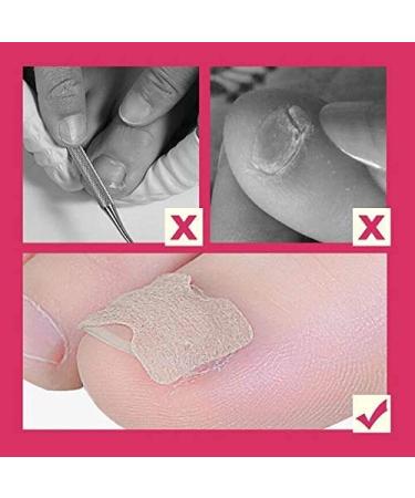 Glue-Free 50PC Ingrown Toenail Patch - Premium Nail Treatment Kit for Ingrown Toenail Removal & Correction - Professional Pedicure Tool for Healthy Nails & Pain Relief - Buy Online on GoSupps.com