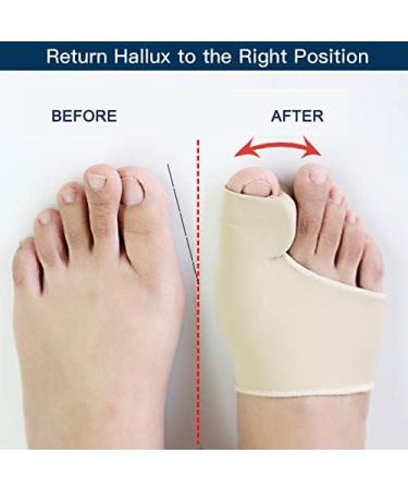 Bunion Corrector & Toe Straightener | Bunion Pain Relief Sleeves with Silicone Gel Pad | Hallux Valgus Support Protectors (Upgrade) - 1 Pair - Buy Online on GoSupps.com