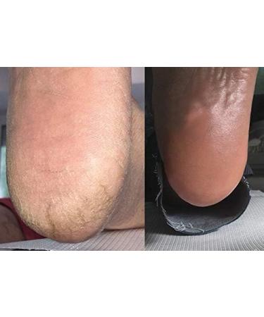 Arkada Skin Ointment Antibacterial Cream Antifungal Moisturizing For Nails Feet Hands And Elbows - Buy Online on GoSupps.com