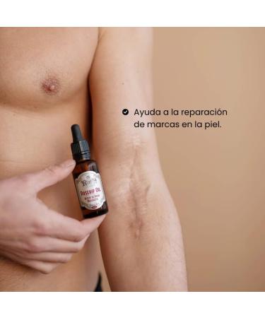 MI REBOTICA | Rosehip Oil 30ml | Rosehip Oil for Scars | High Regenerating Capacity | Repairs Marks and Burns | Reduces Wrinkles | Rosehip Oil - Buy Online on GoSupps.com