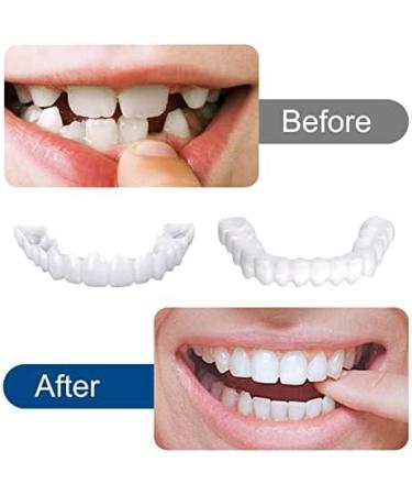 Buy 3 Pairs Snap-On Veneers - Instant Whitening & Comfort Fit for Men & Women | Transform Your Smile & Boost Confidence - Buy Online on GoSupps.com