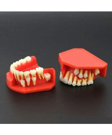 Buy Dental Study Teeth Model with Removable Gums & Permanent Teeth - Ideal for Demonstration & Education | International Shipping Available - Buy Online on GoSupps.com