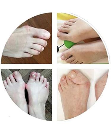 Bunion Corrector for Hammer Toe & Overlapping Toe - Men & Women Bunion Splint for Day & Night Use - Buy Online on GoSupps.com