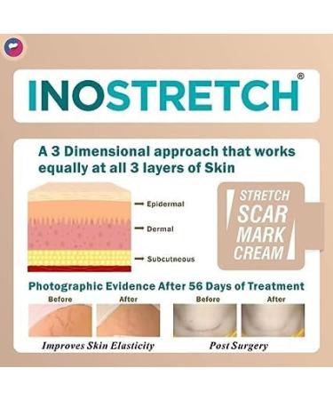 Buy I.nos tretc h Stretch Mark Cream - Reduce Stretch Marks & Scars with Natural Ingredients | 60g - International Shipping Available - Buy Online on GoSupps.com