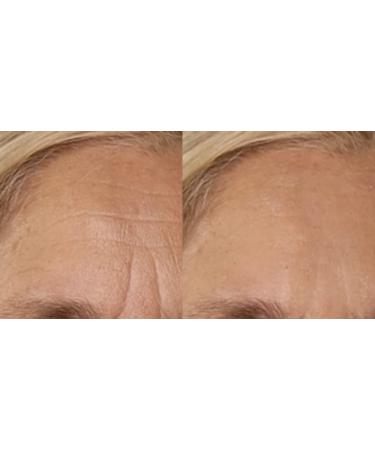 Nakery Skip the Line Instant Wrinkle Eraser - Visibly Reduces Wrinkles & Fine Lines Instantly - Buy Online on GoSupps.com