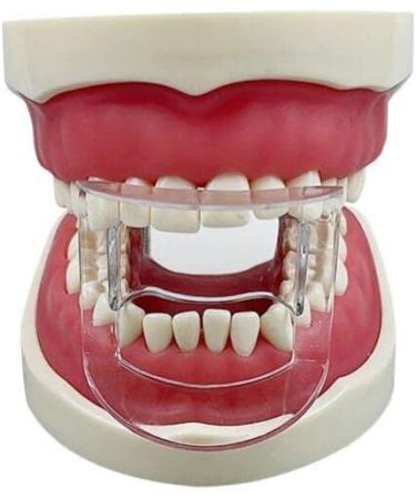 Fopytu Dental Mouth Opener - 5 Pcs Clear Orthodontic Lip Cheek Retractor Expander Accessories for Front Teeth | International Shipping Available - Buy Online on GoSupps.com