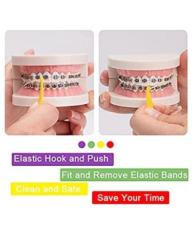 50 Pcs Dental Orthodontic Lingual Buttons - Bondable Round Mesh Base - Buy Online on GoSupps.com