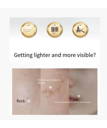 Whitening & Moisturizing Essence - 50ml Freckle Remover (2 Bottles) | Global Shipping - Buy Online on GoSupps.com