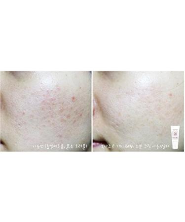 Vegan Beauty Eggplant Daily BHA Moisturizing Cream | Salicylic Acid Anti-Acne Treatment | Natural Moisturizer 1.7 fl. oz - BONAJOUR - Buy Online on GoSupps.com