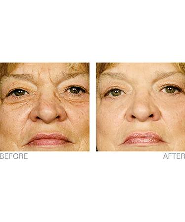 High Potency Hyaluronic Repair Serum - Intensive Moisture Retention for Wrinkles & Dry Skin | Shop Internationally - Buy Online on GoSupps.com