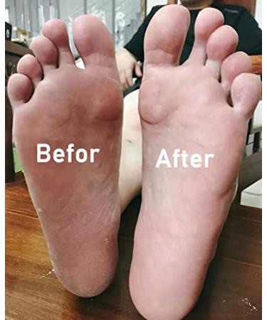 Stainless Steel Feet Scraper Manicure Pedicure Tool for Callus Exfoliating - Silver - Buy Online on GoSupps.com