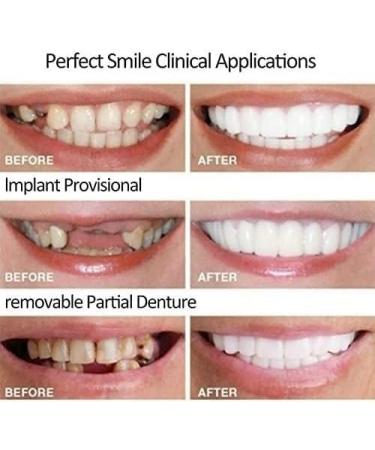 2 Pairs Beautiful Smile Regain Confident Smile for Women and Men Nature and Comfortable(1.0) - Buy Online on GoSupps.com