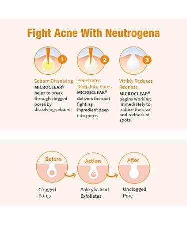 Neutrogena Oil-Free Facial Cleanser with Salicylic Acid for Acne-Prone Skin - 9.1 fl. oz | International Shipping - Buy Online on GoSupps.com