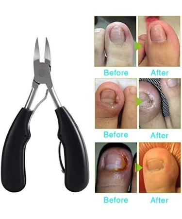 TUSNAKE Toe Nail Clipper Precision Toenail Clipper Tool Heavy Duty Soft Grip Toenail Clipper Manicure Set Nail Clippers Kit for Thick Precision Pedicure Paronychia - Buy Online on GoSupps.com