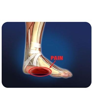 Pro-Tec Athletics Arch Pro-Tec - Premium Plantar Fasciitis Arch Support Pair - Buy Online on GoSupps.com